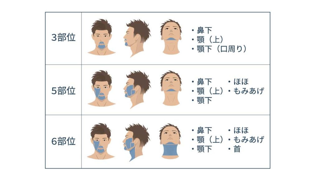 脱毛部位